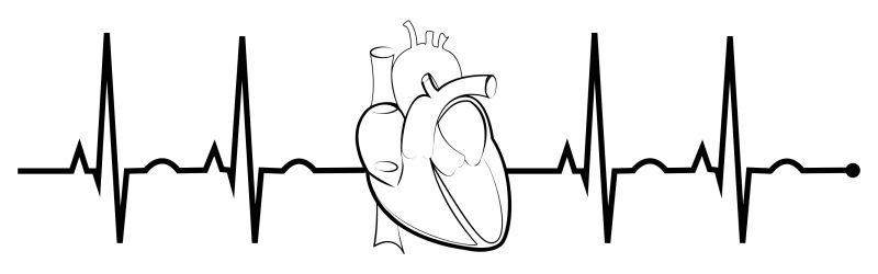 Сердцебиение кардиограмма