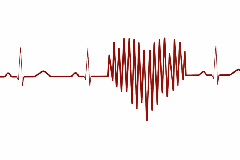 ЭКГ на белом фоне