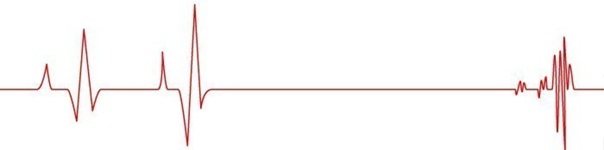 Диаграмма биения сердца