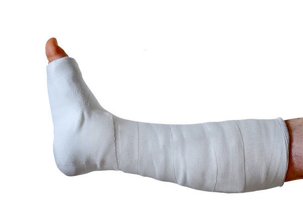 Гипсовая повязка сапожок