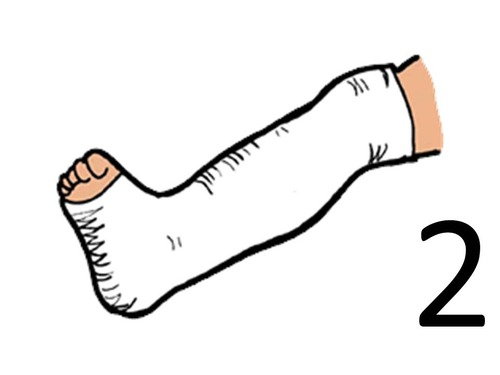 Нога в гипсе вектор