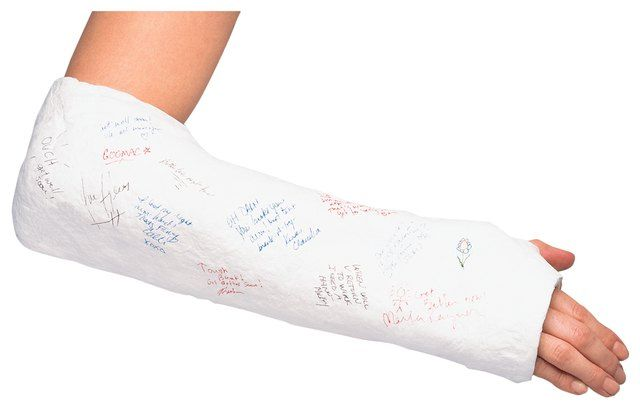 Рука в гипсе на белом фоне