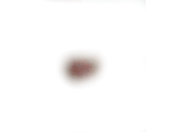 Кровоподтеки на прозрачном фоне