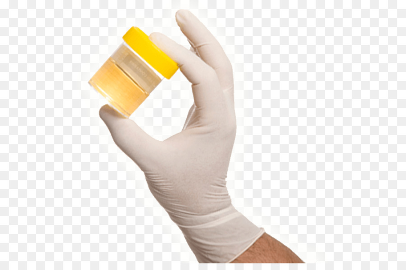 Моча без фона