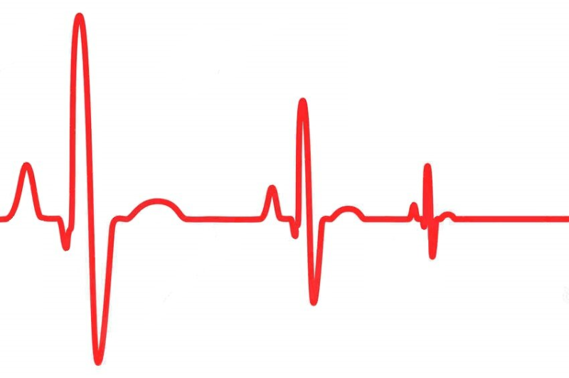 Линия пульса