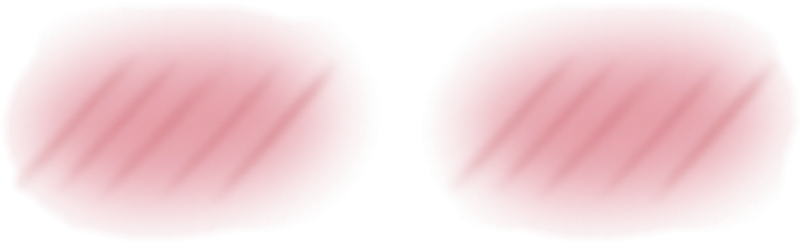 Розовые полоски на щеках