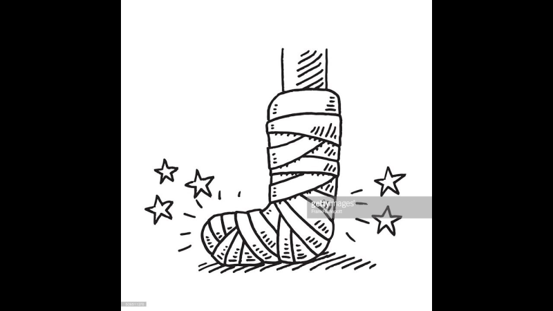 Разукрашенный гипс на ноге