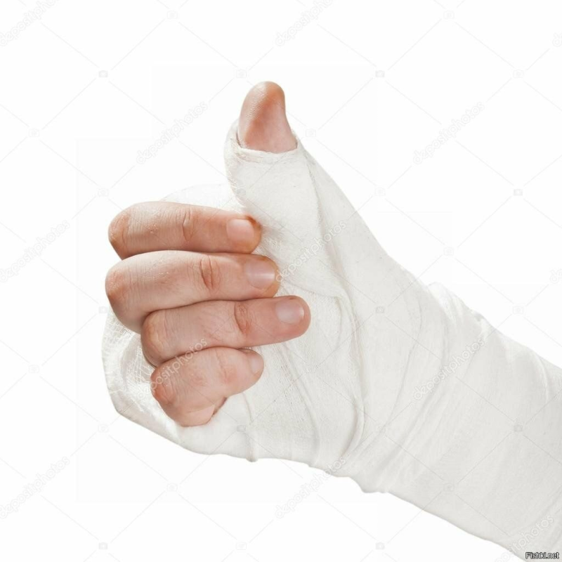 Рука в гипсе на белом фоне