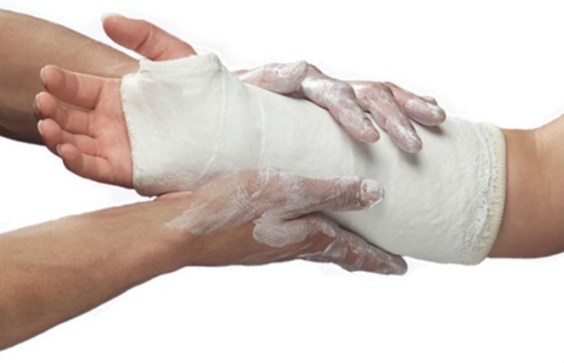 Наложение гипсовой повязки