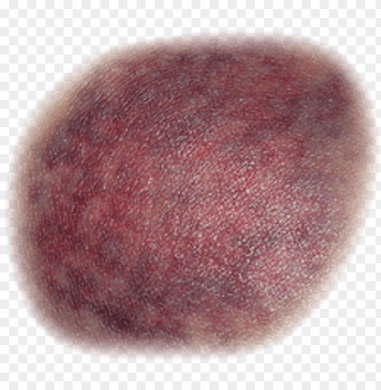 Кровоподтеки на прозрачном фоне