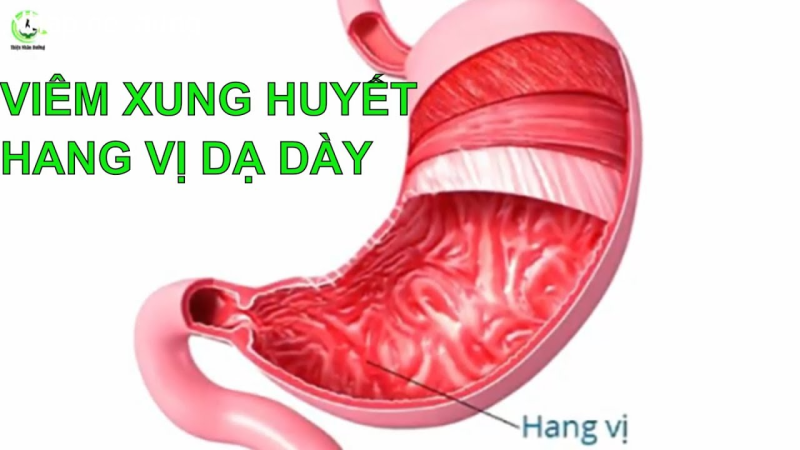 Желудок на белом фоне